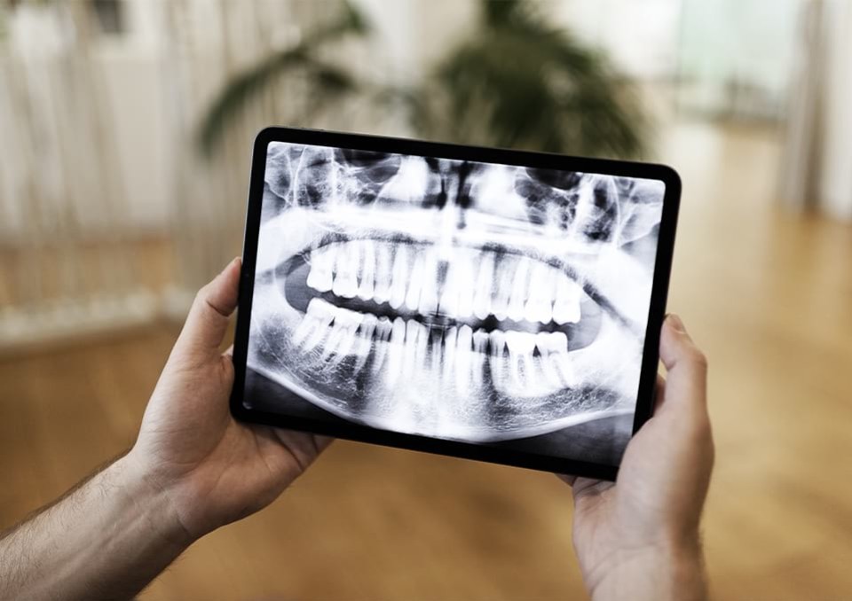Endodontie – Wurzelbehandlung